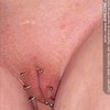 33