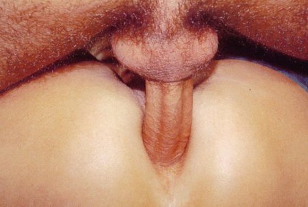 96